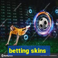 betting skins