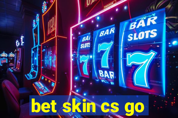 bet skin cs go