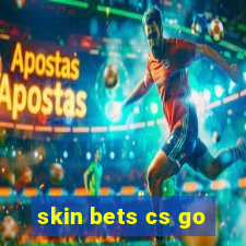 skin bets cs go